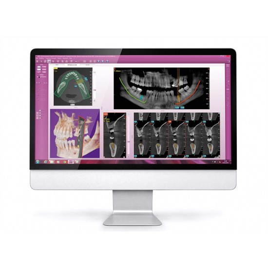 MyRay Hyperion X5 3D/2D
