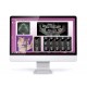 MyRay Hyperion X5 3D/2D