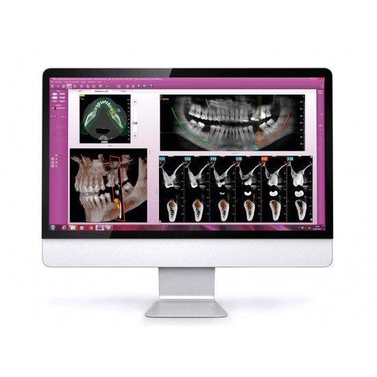 MyRay Hyperion X9 3D/2D MyRay Hyperion X9 3D/2D